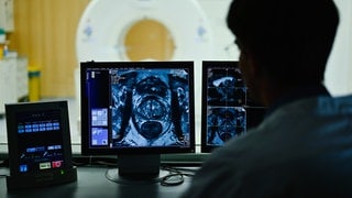 Ein Mitarbeiter betrachtet in einem Kontrollraum des Deutschen Krebsforschungszentrums (DKFZ) auf einem Monitor das Querschnittsbild einer Prostata. 