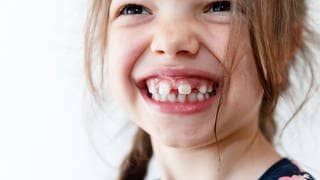 Kind mit wenigen Zähnen im Mund